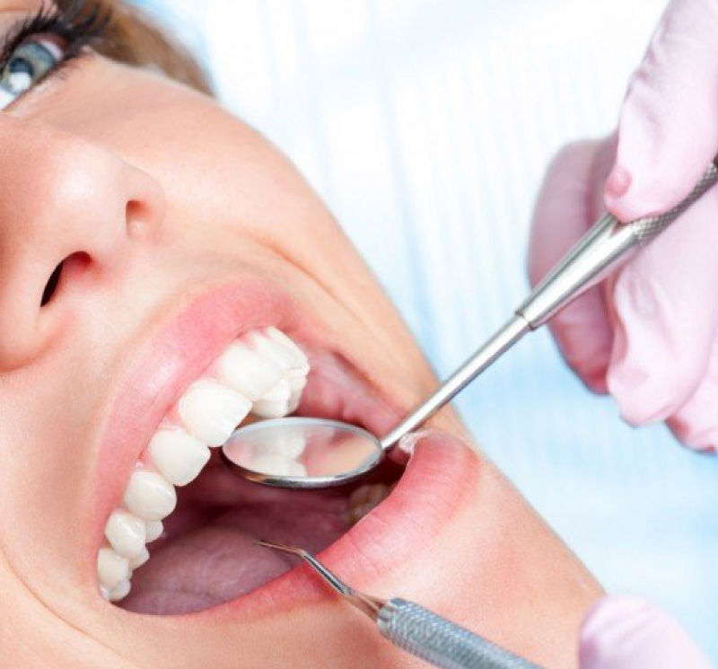 Immagine per servizio Prevenzione cura dentale fornito da Art Dental - Studio dentistico Pennacchio a Giugliano in Campania