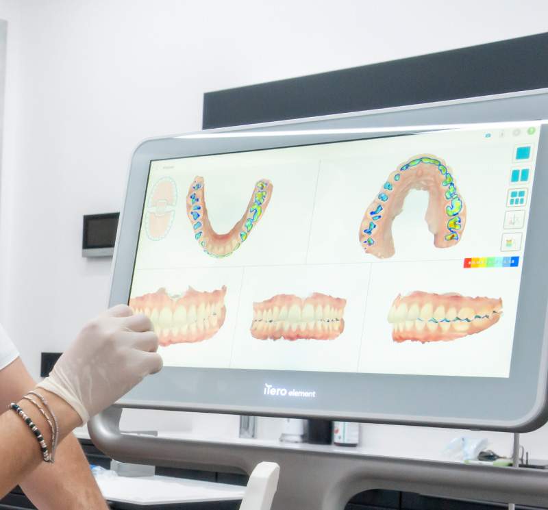 Immagine per servizio Scansione 3D del cavo orale fornito da Art Dental - Studio dentistico Pennacchio a Giugliano in Campania